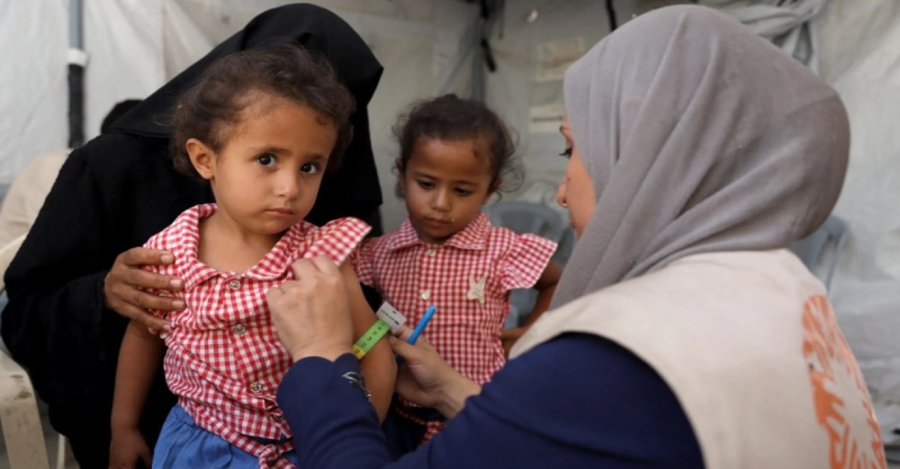 অপুষ্টিতে ভুগছে গাজার শিশুরা
