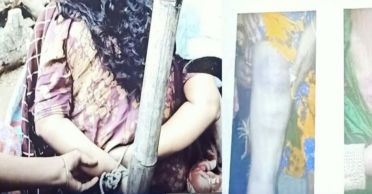 যশোরে মধ্যযুগীয় কায়দায় হাত-পা বেঁধে গৃহবধুকে নির্যাতন
