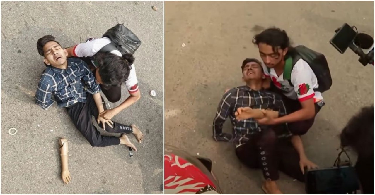 পুলিশের লাঠিচার্জে খুলে গেল জুলাই যোদ্ধার কৃত্রিম হাত